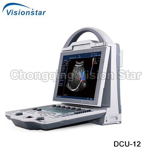 UCD12 Portable Laptop Color Doppler Ultrasound Machine