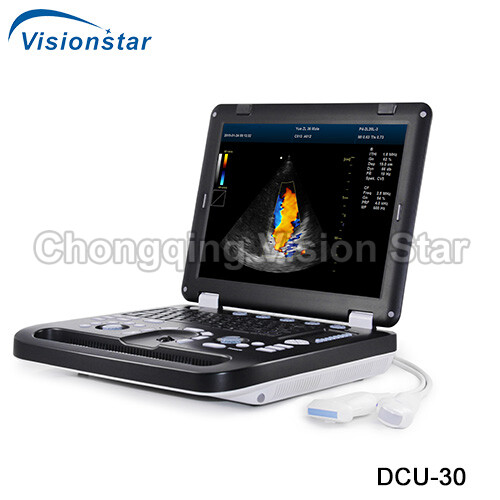 DCU-30 4D Portable Laptop Color Doppler Ultrasound Machine