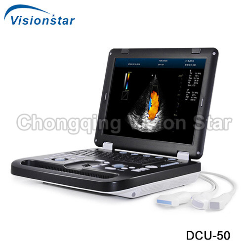 UCD50 Laptop Color Doppler Ultrasound Machine