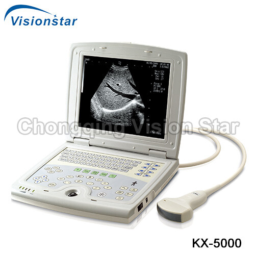 KX-5000 B/W Portable Laptop Ultrasound Machine
