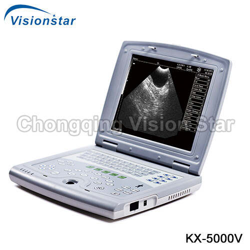 KX-5000V Veterinary B Mode Portable Laptop Ultrasound Machine
