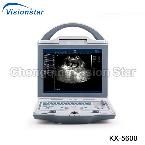 UBW5600 B/W Laptop Ultrasound Machine