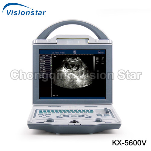 KX-5600V B Mode Portable Laptop Veterinary Ultrasound Scanner