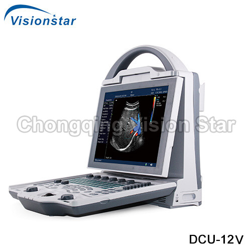 DCU-12V Veterinary Portable Laptop Color Doppler Ultrasound Machine