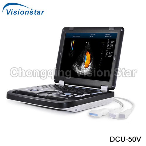 DCU-50V 4D Color Doppler Portable Laptop Veterinary Ultrasound Machine