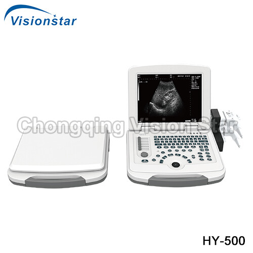 HY-500 Laptop Portable Black and White Ultrasound Machine