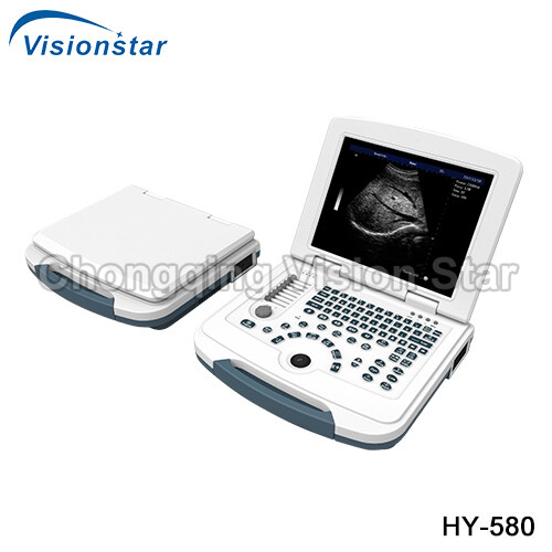 UBW580 Full-Digital Laptop Portable Ultrasound Machine