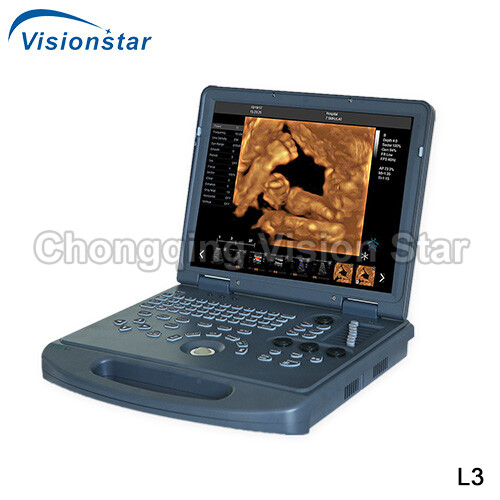 L3 Laptop Color Doppler 4D Portable Ultrasound Scanner