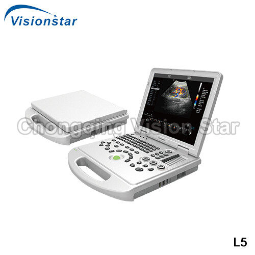 UCD5L Laptop 4D Color Doppler Portable Ultrasound Scanner
