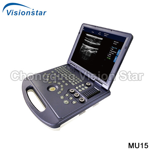 MU15 Windows System Full-digital Black and White Laptop Portable Ultrasound 