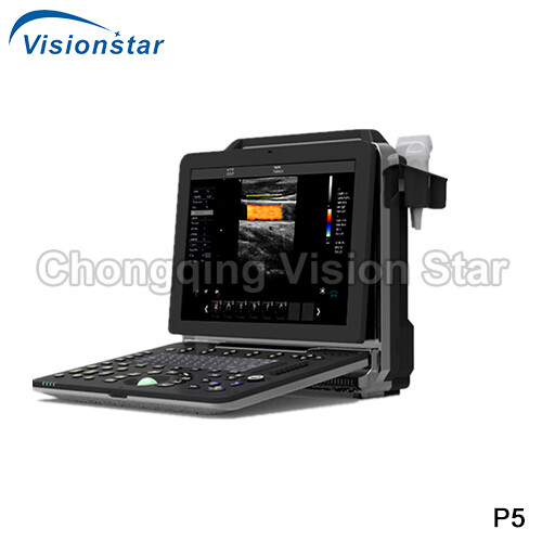UCD5P Laptop 4D Color Doppler Portable Ultrasound Scanner
