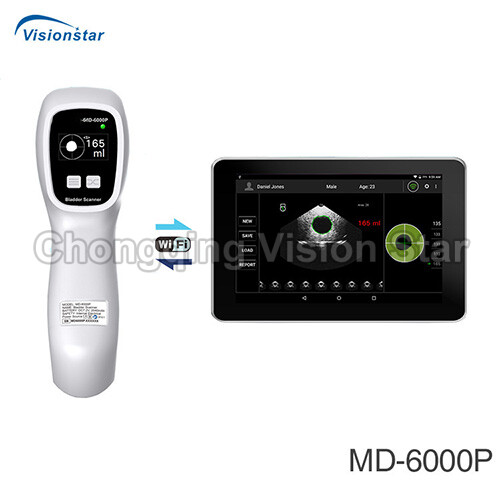 MD-6000P Handheld Bladder Scanner