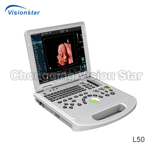 UCD50L Laptop Color Doppler Ultrasound Machine
