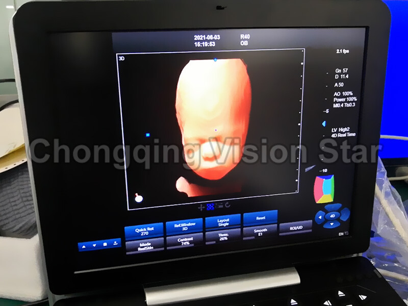 P50 5D Doppler Ultrasound Machine Screen
