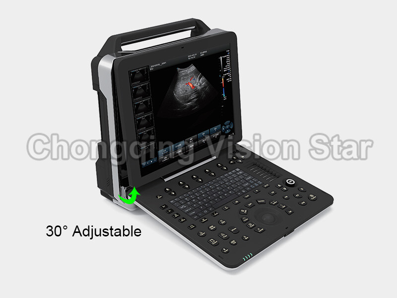 P50 5D Doppler Ultrasound Machine Tilting Screen