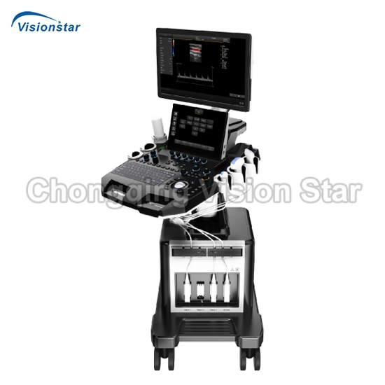 UCD30T 4D Color Doppler Trolley Type Ultrasound