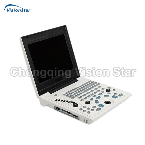 UBW5K Laptop B/W Ultrasound Scanner